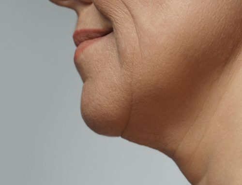 Ditching the “Normal Aging” Excuse: How to Spot and Defeat Bias in Healthcare